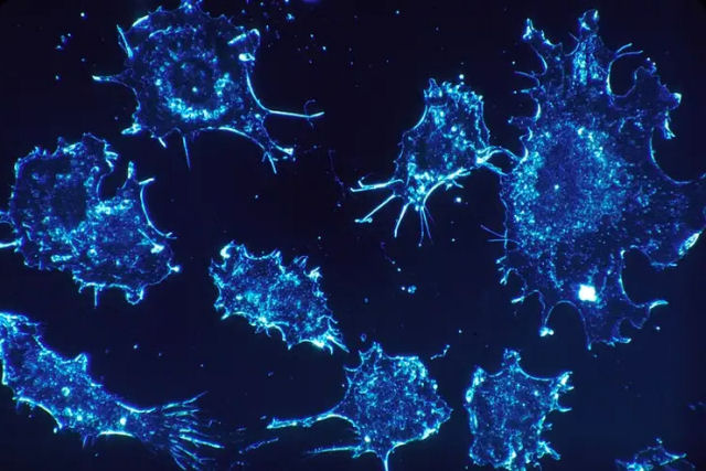 Nova terapia contra o câncer consegue uma remissão de 100% em todos os pacientes