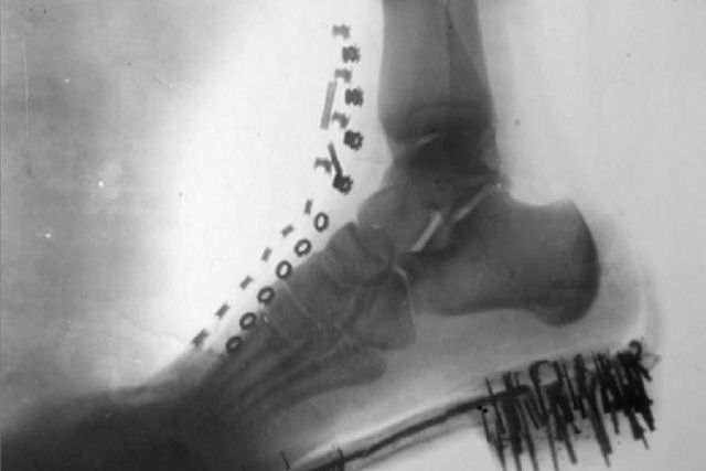 Nikola Tesla fez um raio-X de seu prprio p com uma mquina que ele inventou em 1896