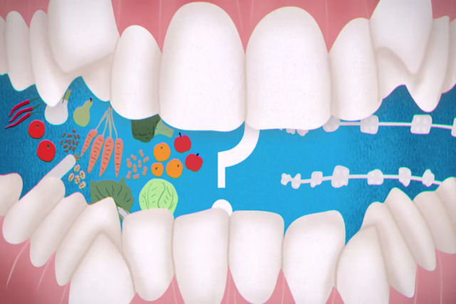 Como os primeiros humanos tinham dentio perfeita sem ortodontia?