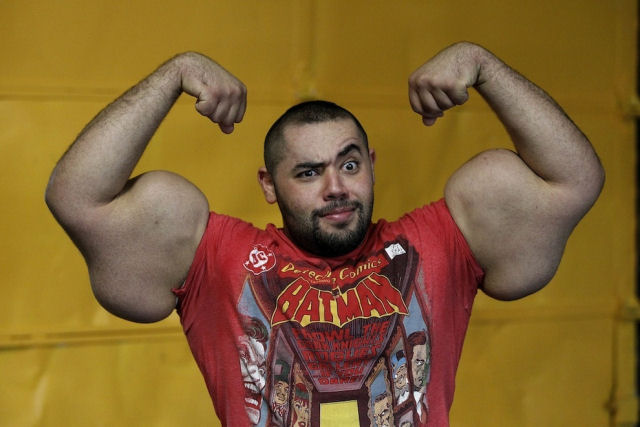 Por que alguns 'fisiculturistas' continuam usando Synthol, apesar do risco que representa?