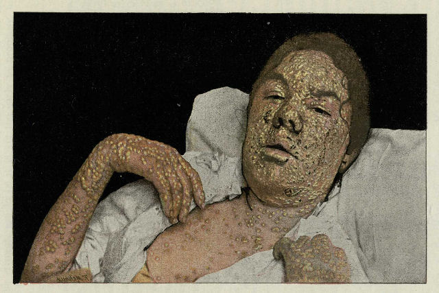 É incrível que tenhamos prosperado mesmo com a quantidade de dpenças que assolou a humanidade