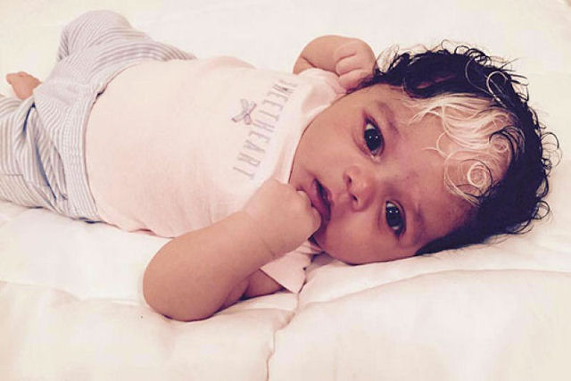 Por que algumas pessoas nascem com mechas de cabelo branco?