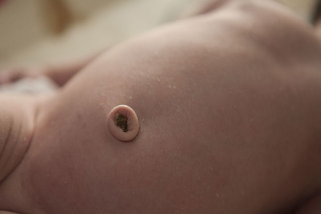 Examinar o umbigo pode revelar muito sobre a sua sade