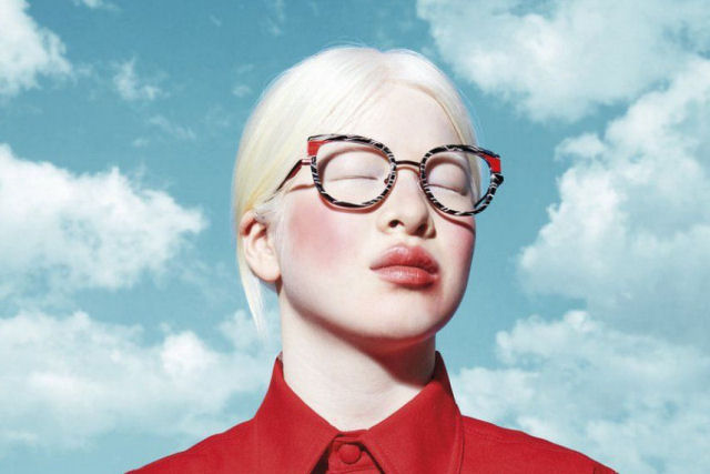 Em alguns lugares do mundo o albinismo � uma verdadeira maldi��o