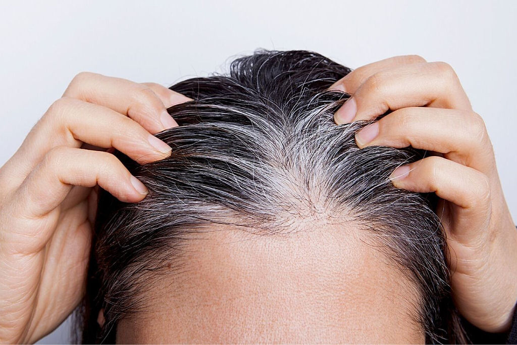 Por que o cabelo fica grisalho � medida que envelhecemos? H� alguma forma de combat�-lo?